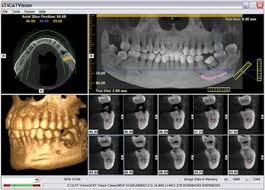 Dental Implants Manhattan